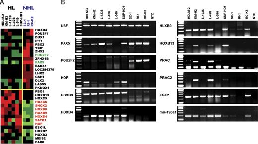 Figure 1. Gene expression analysis. (A) Expression profiling data were converted into a heatmap using CLUSTER and TREEVIEW software (red indicates high; green, low; black, medium expression level). Data show homeobox genes differentially expressed in HL and NHL cell lines. Genes showing significant up-regulation/down-regulation in HL (HOXC6, SHOX2, HOXB8, HOXB9, HOXB4, SATB1, HOP/PAX5, POU2F2), shown in red/green, respectively, were subsequently analyzed by RT-PCR, depicted in panel B together with HLXB9, genes located within the HOXB cluster (HOXB13, PRAC, PRAC2, mir-196a1) and involved in HOXB9 transcription (FGF2). Expression of upstream binding factor (UBF) was used as positive control for cDNA quality. NTC indicates no template control.
