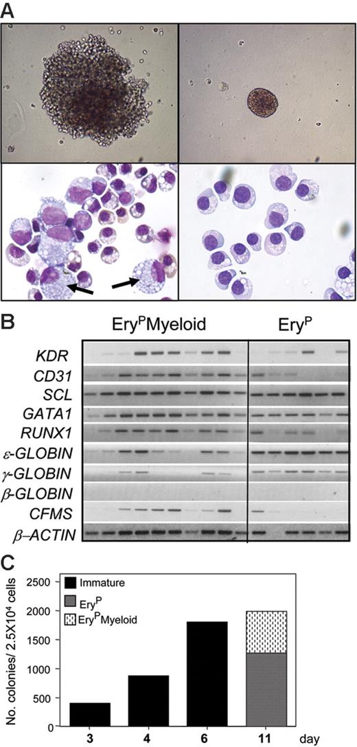 Figure 5. Development of 2 populations of hemangioblasts. (A, top row) Photograph of an 11-day-old EryPMyeloid–restricted (left) and EryP-restricted (right) blast colony (original magnification, × 200). (A, bottom row, left) Photograph of erythrocytes and macrophages (arrows) from an individual EryPMyeloid blast colony, and (right) erythroid cells from a pool of EryP blast colonies. Original magnification: × 1000. (B) Expression analyses of 10 individual EryPMyeloid and 6 EryP blast colonies. (C) Kinetics of blast colony development from KDR+ cells isolated from day-4 EBs.