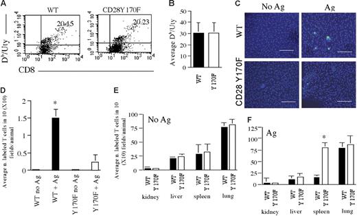 Figure 4. HY-specific memory CD28Y170F T cells display defective localization to antigenic sites in vivo. (A) Percentage of Uty-specific CD8+ T cells (as determined by Db/Uty tetramer binding) detected in WT and CD28Y170F female mice after 2 immunizations with male splenocytes (cells are gated based on CD8 expression). (B) Average percentage of Uty-specific T cells in 3 samples. Standard error bars are shown. (C-D) Localization of CFSE-labeled T cells obtained from immunized WT and CD28Y170F female mice and injected in a female recipient that had either received an intraperitoneal injection of IFNγ only (No Ag) or that had also been injected with male splenocytes on the same day and Uty peptide 48 hours later (+ Ag). Cells were visualized in the peritoneal membrane (C; scale bar: 40 μm) and in the organs indicated in panels E-F 24 hours later by wide-field fluorescence microscopy and quantified as described in “Materials and methods.” Panels D-F represent data averaged from at least 3 animals, and standard error bars are shown. (D) *P < .03; (F) *P < .04.