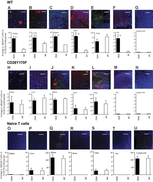 Figure 5. CD28-triggering enhances T-cell trafficking into nonlymphoid organs and promotes promiscuous T-cell recruitment to homing-“privileged” sites. Infiltration of the indicated tissues by HY-specific WT (A-G) and Y170F T cells (H-N) following CD28 ligation (PKH26 labeled) or treatment with a control antibody (CFSE labeled) is shown. Each panel shows a representative tissue image (scale bar: 30 μm). The mean T-cell infiltration ± SD observed in samples from at least 3 animals is shown (A, *P < .007; B, *P < .05; C, *P < .03; D, *P < .004; F *P < .003).