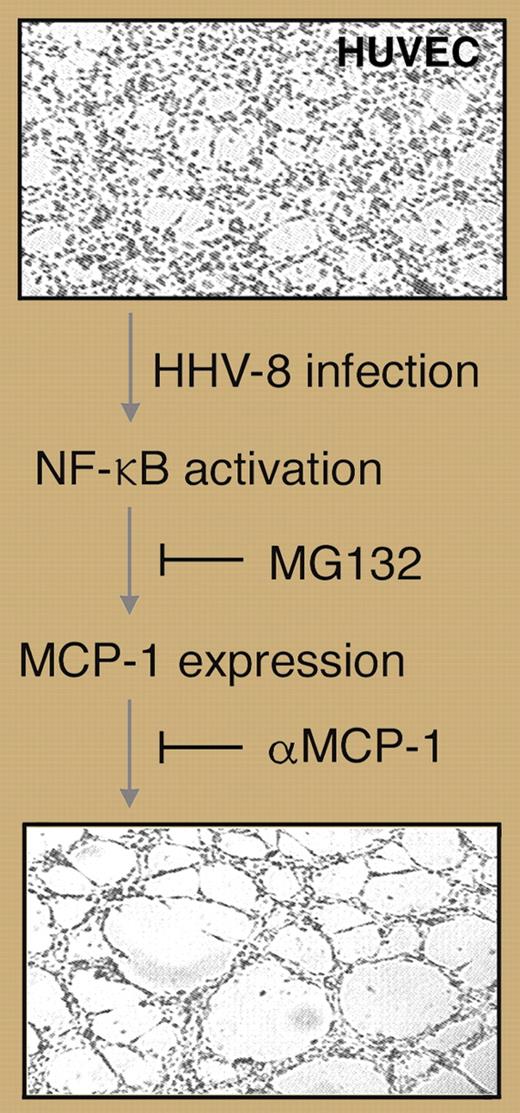 Human umbilical vein endothelial cells (HUVECs) are induced to form capillary-like tubules in response to HHV-8 infection, a process that is dependent on NF-κB–induced MCP-1. Professional illustration by Marie Dauenheimer.