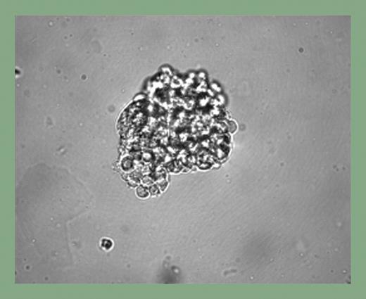 Blast cell colony development from human EBs. See the complete figure in the article beginning on page 2679.