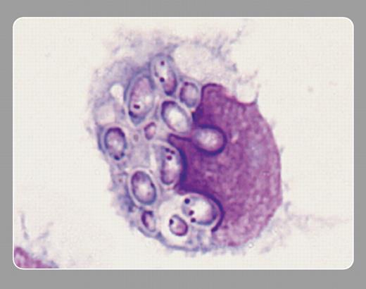 Peter Maslak and Lisa Southern, Memorial Sloan-Kettering Cancer Center