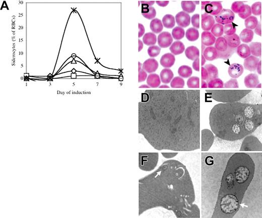 Figure 1. Transient siderocytosis following Mx1-Cre–mediated Abcb7 gene deletion. (A) Serial peripheral blood siderocyte counts in 5 representative Abcb7fl+Mx1-Cre animals induced at 4 days of age. Iron-stained peripheral blood smears of Abcb7fl−Mx1-Cre (B) and Abcb7fl+Mx1-Cre (C) animals. Black arrows indicate cells with siderotic granules. Transmission electron micrographs of reticulocytes in Abcb7fl animals with or without Mx1-Cre (D) −Cre, conventional electron microscopy (EM) stain; (E) +Cre, conventional EM stain; (F) −Cre, EM Fe stain; (G) +Cre EM Fe stain. White arrows indicate a representative mitochondrion in each field. Note the increased electron density of the mitochondrial membranes in panel G. Electron micrographs: original magnification, ×24 000.