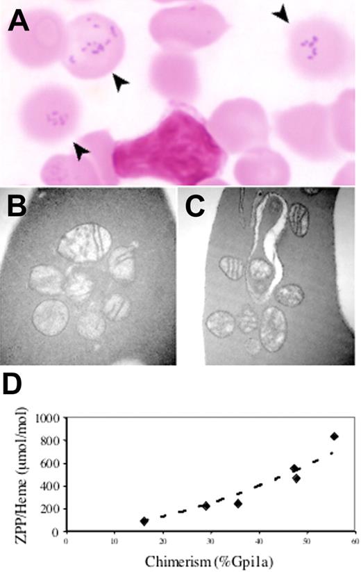 Figure 3. An Abcb7E433K mutation results in siderocytosis with increased zinc protoporphyrin. (A) Siderocytes (arrows) in the peripheral blood of an Abcb7E433K chimera (Fe stain). Transmission electron micrographs of Abcb7E433K chimera reticulocytes unstained (B) or with Fe stain (C). Original magnification ×44 000. (D) RBC zinc protoporphyrin-to-heme ratio as a function of Abcb7E433K chimerism measured by Gpi1 isozyme. Normal is typically less than 100 ng/μg for mice.