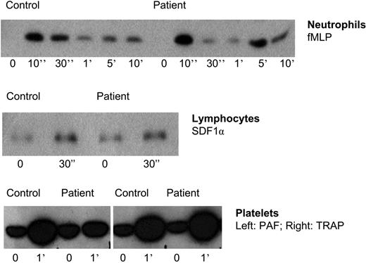 Figure 4. Rap-1 activation in leukocytes and platelets of patients suffering from LAD-1/variant syndrome. TRAP indicates thrombin receptor-derived activation peptide. Representative for 5 patients.