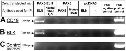 Figure 5. ChIP experiments on CD19 and BLK promoters. (A) PCR amplification of the CD19 promoter fragments after ChIP: PAX5-ELN binds CD19 promoter sequences as PAX5. (B) PCR amplification of the BLK promoter. PAX5-ELN binds BLK promoter sequences as PAX5. (C) Non-PAX5 target sequence PCR control. PCR amplification of the SERPINA1 promoter.
