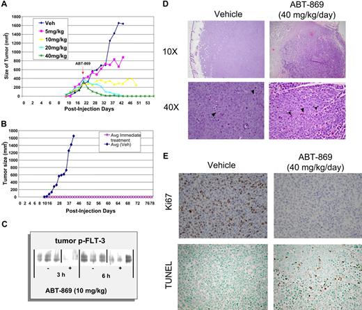 Figure 6. ABT-869 exhibits dose-dependent efficacy and regression of established subcutaneous MV-4-11 tumors. (A) Daily oral administration of ABT-869 at concentrations of 5, 10, 20 and 40 mg/kg/day was initiated when the MV-411 tumors reached an average of 400 mm3 in volume. The graph shows the dosage response to the inhibitor compared with tumors treated with vehicle control (3 mice per group). (B). Mice injected with MV-411 cells were treated with 40 mg/kg/day ABT-869 or vehicle the day after the injection of cells. The graph shows that the mice receiving treatment never developed tumors in contrast to the vehicle control (3 mice per group). (C) After a single administration of ABT-869 (10 mg/kg), tumors were harvested 3 and 6 hours later, snap-frozen in liquid N2, homogenized in lysis buffer, immunoprecipitated with anti-PY20, and analyzed by Western blot with anti-FLT3. (D) H&E sections of tumors from day 12 of dosing treated with vehicle or 40 mg/kg/d of ABT-869 at low (× 10) and high (× 40) power. Vehicle control–treated tumors show increased mitotic activity (arrowheads, lower left panel). Treated tumors show areas of cell death and inflammatory cells (arrowheads, lower right panel). (E) Ki67 and TUNEL staining of tumor sections from day 12 of dosing were used to evaluate proliferation and apoptosis, respectively.