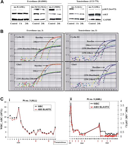 Figure 2. Rapamycin derivatives inhibit AKT signaling in leukemic cells in vivo. (A) Peripheral blood mononuclear cells from patients treated with either everolimus or temsirolimus were subjected to immunoblotting analyses of pAKT, total AKT, and GAPDH, and (B) quantitative real-time PCR analysis of CCND1/CCND2 and GLUT1 transcription. The data shown are derived from TaqMan PCR analyses of these genes. (C) Changes in white blood cell count (WBC, 109/L) and absolute blast count (ABC, 109/L) during temsirolimus treatment. (i) Patient with relapsed refractory pre-B-cell acute lymphoblastic leukemia (pre-B-ALL) received 3 doses of temsirolimus at a dose of 25 mg intravenously every week (indicated by arrows). (ii) Patient with primary refractory AML has completed 2 courses of temsirolimus (4 weekly injections each, at a dose of 25 mg intravenously every week) and received 2 doses of temsirolimus in course 3.