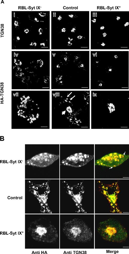 Figure 1. Localization of endogenously and ectopically expressed HA-TGN38 in control, Syt IX knocked-down, or Syt IX-overexpressing RBL cells. (A) Control RBL (ii,v,viii) RBL-Syt IX− (i,iv,vii) and RBL-Syt IX+ (iii,vi,ix) cells were either labeled with monoclonal anti-TGN38 (i-iii) or were transiently transfected with HA-TGN38 cDNA (iv-ix), grown on glass coverslips for 48 hours, and subsequently labeled with monoclonal anti-HA antibodies followed by Cy3-conjugated donkey anti–mouse IgG. Bars equal 10 μm (i-vi) and 3 μm (vii-ix). (B) Control RBL, RBL-Syt IX−, and RBL-Syt IX+ cells were transiently transfected with HA-TGN38 cDNA and grown on glass coverslips for 48 hours. Cells were subsequently labeled with polyclonal anti-HA antibodies and monoclonal anti-TGN38 antibodies, followed by FITC- or Cy3-conjugated donkey anti–mouse or anti–rabbit IgG. Bars represent 3 μm.