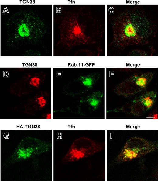 Figure 2. Localization of endogenously and ectopically expressed HA-TGN38 in Tfn-loaded or Rab 11-GFP–expressing cells. RBL-Syt IX+ cells (A-C) or RBL-Syt IX+ cells transiently transfected with either Rab 11-GFP (D-F) or HA-TGN38 (G-I) cDNAs were grown on glass coverslips for 48 hours, serum starved for 1 hour, and allowed to internalize Texas red-conjugated Tfn (50 μg/mL) for 30 minutes (A-C,G-I). Cells were subsequently labeled with monoclonal anti-TGN38 (A-F) or anti-HA (G-I) antibodies followed by FITC- or Cy3-conjugated donkey anti–mouse IgG. Bars represent 4 μm.