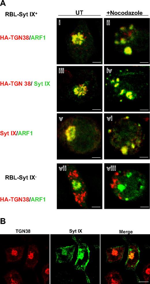 Figure 6. Cellular localization of Syt IX, ARF1, and TGN38. (A) RBL-Syt IX+ (i-vi) and RBL-Syt IX− (vii-viii) cells were transiently transfected with ARF1-GFP cDNA (i-ii,v-viii) or with HA-TGN38 cDNA (i-iv,vii,viii). Cells were grown on glass coverslips for 24 hours and either left untreated (UT) or treated with nocodazole (20 μM) for 2 hours, as indicated. Cells were subsequently labeled with monoclonal anti-HA antibodies (i-iv,vii-viii) or polyclonal anti–Syt IX antibodies (iii-vi) followed by Cy3- or FITC-conjugated donkey anti–mouse or anti–rabbit IgG as indicated. Bars represent 3 μm. (B) RBL-Syt IX+ cells were double labeled with polyclonal anti–Syt IX and monoclonal anti-TGN38 antibodies followed by FITC- or Cy3-conjugated donkey anti–mouse or anti–rabbit IgG. Bars represent 8 μm.