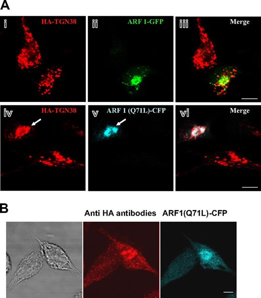 Figure 7. Inhibition of ERC-to-MVBs/SGs transport in RBL-Syt IX− cells by a GTPase-deficient mutant of ARF1. (A) RBL-Syt IX− cells were cotransfected with HA-TGN38 and either ARF1-GFP (i-iii) or ARF1(Q71L)-CFP (iv-vi) cDNA and grown on glass coverslips for 24 hours. Cells were labeled with monoclonal anti-HA antibodies followed by Cy3-conjugated donkey anti–mouse IgG. Bars equal 5 μm. The arrow points to a cell double-transfected with HA-TGN38 and ARF1(Q71L)-CFP. (B) RBL-Syt IX− cells were double-transfected with HA-TGN38 and ARF1(Q71L)-CFP cDNA and grown on glass coverslips for 48 hours. Cells were then incubated with monoclonal anti-HA antibodies (2 μg/mL) for 30 minutes at 4°C, washed, and subsequently incubated at 37°C for 30 minutes. Cells were labeled with Cy3-conjugated donkey anti–mouse IgG. Bars represent 8 μm. The phase-contrast image is shown on the left.