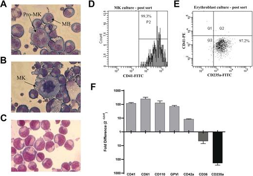 Figure 1. Characterization of MK and EB cultures. (A-B) Megakaryocyte morphology, the MK cultures were predominantly in the megakaryoblast (MB) or promegakaryocyte (pro-MK; horseshoe-shaped nucleus) stage of differentiation, although some large granular MKs (multilobed nucleus) were observed. (C) Erythroblasts (EBs) were in the proerythroblast stage of differentiation. (D) Flow cytometric analysis of MKs and EBs after sorting. After FACS sorting, 99.3% of the cells were positive for CD41. The parallel EB culture (E) was sorted to a purity of 97.2% (based on CD235a expression). (F) Confirmation of differential expression of lineage-associated markers by TaqMan real-time PCR. Data presented as fold difference in expression (corrected for GAPDH) between paired MK and EB cultures. Error bars represent the SEM of biologic (n = 5) and technical (n = 3) replicates combined. Values above the x-axis indicate genes up-regulated in MKs, whereas values below indicate genes up-regulated in EBs. Cells were stained using modified May-Grünwald eosine-methylene blue solution (Merck) and 0.5 mM KH2PO4, pH 7.4. Images were acquired using a Leica DM 1L microscope (Leica, Mannheim, Germany) equipped with a Leica objective C, plan L 40×/0.50 numerical aperture PH2 with a total magnification of 400×. Images were captured using a Leica DC300 digital camera and Leica imaging software (IM500, version 1.20).