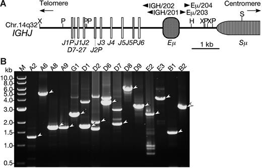 Figure 2. LDI-PCR of the IGH locus in BCP-ALL with CEBP/IGH translocations. (A) Restriction enzyme map of the IGHJ region. The map was constructed based on the GenBank database (accession number NG_001019).42 Boxes represent diverse and junctional region of the IGH (D, J, respectively), IGH-specific enhancer region (Eμ), and switch region (Sμ). Arrowheads are the positions of primers for LDI-PCR. Restriction sites are as follows: H indicates HindIII; P, PstI; S, SacI; and X, XbaI. (B) Ethidium bromide–stained gel electrophoresis of LDI-PCR showing CEBP/IGH fusion genes. The LDI-PCR products representing fusions are indicated by arrowheads. An aliquot of 2 to 10 μL was loaded in each lane and electrophoresed through a 0.7% agarose gel. A DNA ladder (1 kb) was used as a molecular-weight marker.