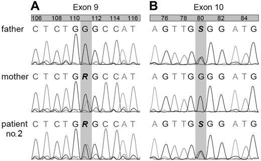 Figure 4. Sequence profile of family 2. The numbers on top refer to the position of the nucleotides in the respective exons in the cDNA of the cytosolic form of GR. (A) Exon 9, around 861G in GSR. (B) Exon 10, around 989G. R and S indicate the nucleotides that differ between the 2 alleles.