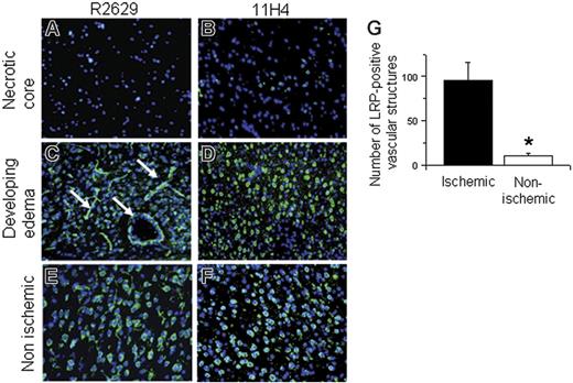 Figure 2. Development of LRP-positive vascular structures in the murine brain 24 hours after middle cerebral artery occlusion. Wild-type mice were subjected to MCAO and killed 24 hours later. Tissue sections were prepared from the necrotic core (A-B), area of developing edema (C-D), and a corresponding area in the healthy, nonischemic contralateral hemisphere (E-F) and stained with either the R2629 (A,C,E) or the 11H4 antibody (B,D,F). Green is LRP staining and blue is DAPI. Arrows depict examples of LRP-positive vascular structures. (G) Number of LRP-positive vascular structures in the 3 areas of interest in the ischemic and nonischemic hemispheres 24 hours after the onset of cerebral ischemia. Error bars describe standard error of the mean; n = 6; *P < .05. Magnification, ×40 (A-F). Images were acquired as in Figure 1, except that a 40×/0.70 NA objective was used.