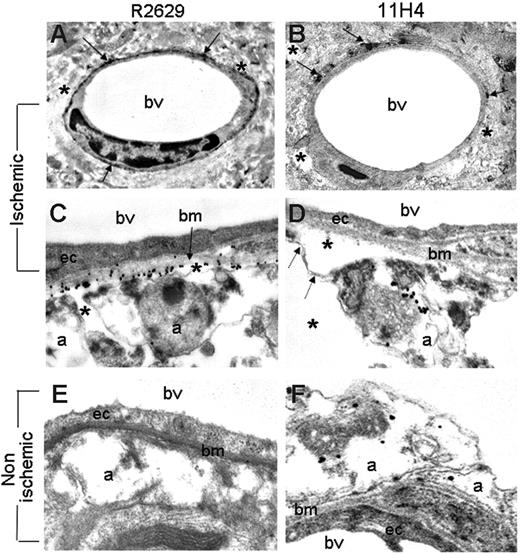Figure 3. Effect of cerebral ischemia on LRP in the neurovascular unit. Electron microscopy analysis of LRP expression in the NVU in the ischemic (A-D) and corresponding nonischemic (E-F) hemispheres 6 hours after MCAO. Brains were stained with either the R2629 (A,C,E) or the 11H4 (B,D,F) antibodies. Arrows in panel A depict the presence of LRP-positive areas surrounding the blood vessel. Arrows in panel B point to LRP-positive perivascular astrocytes. Asterisks in panels A to D show areas where the perivascular astrocyte has detached from the basement membrane with development of early perivascular edema. Dashed arrows in panel D depict areas of astrocytic detachment of the glia limitants. Bv indicates blood vessel; bm, basement membrane; a, perivascular astrocyte; ec, endothelial cell. Magnification, ×5000 (A-B) and ×30 000 (C-F). Images were visualized using a Hitachi H-7500 electron microscope (Hitachi, Tokyo, Japan).