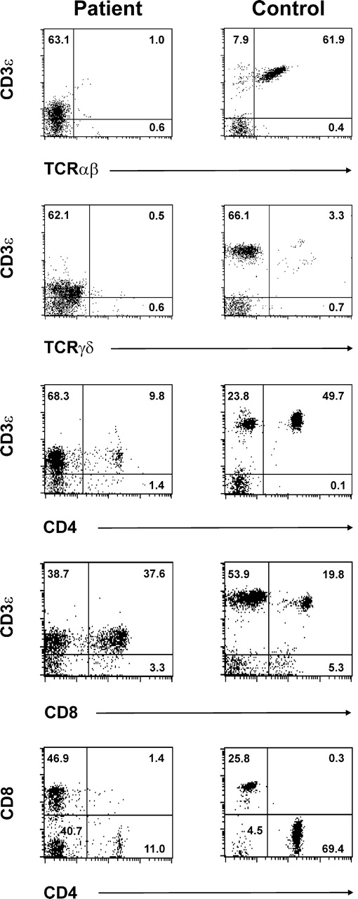 Figure 1. Phenotype of patient CD3ε+ cells. Patient and healthy volunteer PBMCs were stained and analyzed by 4-color flow cytometry. Data were collected on CD14−CD45+ lymphocytes. Shown are 2-color plots of cells stained with PerCP-labeled anti-CD3ε plus anti-TCRαβ-FITC (top row 1), PerCP-labeled anti-CD3ε plus anti-TCRγδ-PE (row 2), anti-CD3ε-APC and anti-CD4-FITC (row 3), or anti-CD3ε-APC and anti-CD8-PerCP (row 4). The 2-color plots in bottom row 5 depict anti-CD4-FITC and anti-CD8-PerCP staining on software-gated CD3ε+ cells. The selected gate is shown in rows 3 and 4 and was based on anti-CD3ε-APC staining intensity. Numbers represent the frequency of cells present in the indicated quadrant.