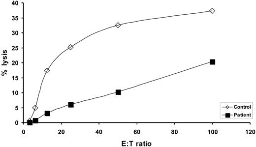 Figure 3. Patient NK cell function. Values represent the percent specific lysis of 51Cr-labeled K562 target cells by patient or healthy control PBMCs, as indicated, following incubation for 4 hours at effector-to-target (E/T) ratios of 3:1, 6:1, 12:1, 25:1, 50:1 and 100:1.