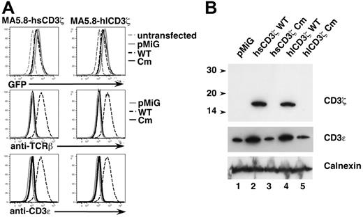 Figure 6. Patient mutant CD3ζ fails to rescue TCR expression in retrovirally-transduced CD3ζ-deficient MA5.8 cells. (A) MA5.8 cells were transduced with individual retroviral vectors containing one of the following human CD3ζ cDNAs: hsCD3ζWT (wild-type CD3ζ transcript variant 2), hsCD3ζCm (patient 411insC mutant CD3ζ transcript variant 2), hlCD3ζWT (wild-type CD3ζ transcript variant 1), or hlCD3ζCm (patient mutant CD3ζ transcript variant 1). Cells were also transduced with pMiG vector alone. Depicted are 1-color histograms of transduced MA5.8 cells analyzed for expression of eGFP indicator protein, surface TCRβ, or surface CD3ε by flow cytometry. (B) MA5.8 cells retrovirally transduced with the indicated cDNAs were lysed in digitonin lysis buffer, resolved by SDS-PAGE, and immunoblotted with anti-CD3ζ Ab (top panel) and anti-CD3ε Ab (middle panel). The membrane was also probed with anti-Calnexin Ab (bottom panel) to assess gel loading.