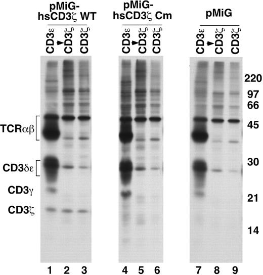 Figure 7. MA5.8 cells transduced with patient mutant CD3ζ cDNA do not express detectable CD3ζ protein and fail to assemble complete TCR complexes. MA5.8 hybridoma cells retrovirally transduced with the indicated human CD3ζ cDNAs or pMiG vector alone were metabolically labeled for 30 minutes and lysed in digitonin lysis buffer. Lysates were either sequentially immunoprecipitated with anti-CD3ε Ab followed by anti-CD3ζ Ab or immunoprecipitated with anti-CD3ζ Ab alone. Immunoprecipitated material was resolved by SDS-PAGE and TCR chains visualized by fluorography.