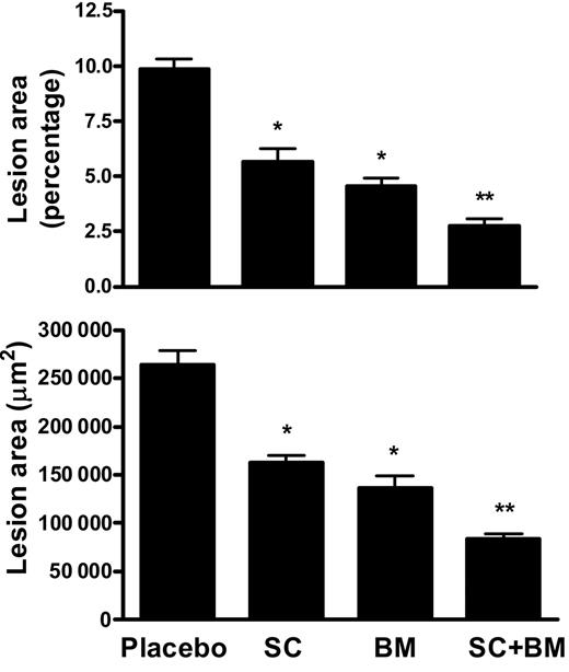 Figure 4. Effects of COX-1 inhibition, TP blockade, or a combination of both on atherogenesis in LDLR KO mice. (A) Quantitation of atherosclerosis by en face method. Percentage lesion formation in mice fed for 12 weeks a high-fat diet containing SC-560 or BM-573 or a combination of both. (B) Quantitation of lesion areas of aortic cross-sections from mice fed for 12 weeks a high-fat diet containing SC-560 or BM-573 or a combination of both. *P < .01 versus placebo; **P < .01 versus SC and BM. Results are presented as mean ± SEM.