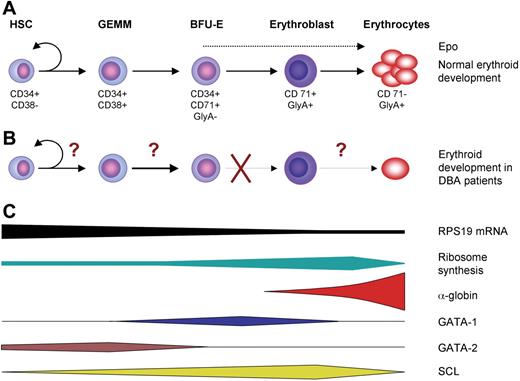Figure 2. Normal and DBA erythropoiesis. (A) Adult erythropoiesis is a process by which single hematopoietic stem cells in the bone marrow differentiate and proliferate into billions of red blood cells. The figure shows a simplified scheme of the series of differentiation processes that takes place during red cell development. The main regulator of terminal erythropoiesis is Epo. Commonly used cell-surface markers that are used to enrich for the different progenitor populations are shown below the cells. (B) In patients with DBA the erythroid development is severely compromised. One convincing study localizes the erythroid defect to the Epo-dependent stages after the BFU-E stage.13 However, since there are reports of decreased BFU-E colony formation and decreased proliferation of multipotent progenitors in patients with DBA, it is possible that more primitive progenitors are affected as well.26 (C) The expression of RPS19 is high in primitive progenitor cells and decrease in more mature erythroid cells. In contrast ribosome synthesis is low in primitive progenitors, whereas mature erythroid precursors have a very high rate of ribosome synthesis to meet the demand for globin synthesis. The illustration showing the timing of expression of erythroid transcription factors is a modified version of a figure by Anguita et al.88 Epo indicates erythropoietin; HSC, hematopoietic stem cell; GEMM, granulocyte/erythrocyte/macrophage/megakaryocute colony-forming unit; BFU-E, erythrocyte burst-forming unit; CD34, positive cell-surface marker for hematopoietic progenitor cells; CD38, negative cell-surface marker for primitive hematopoietic progenitor cells; CD71, transferrin receptor; GlyA, glycophorin A.