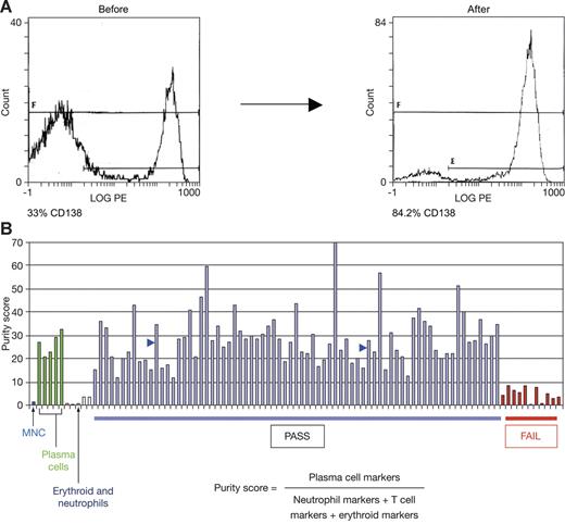 Figure 1. Bone marrow aspirate enrichment procedure effectively depletes nontumor cells. (A) Bone marrow aspirate samples before and after enrichment were subject to CD138 staining and FACS analysis. (B) Myeloma purity score is elevated in control plasma cell samples (> 90% pure) relative to bone marrow mononuclear cells (MNCs), neutrophils, and erythroid cells. Two enriched patient samples of 84% and 91% tumor purity by FACS analysis had scores of 35 and 28, respectively (blue arrows). A score of at least 10 (at least 3-fold elevated relative to the score for nonplasma cell types) was set as a threshold for further analysis.