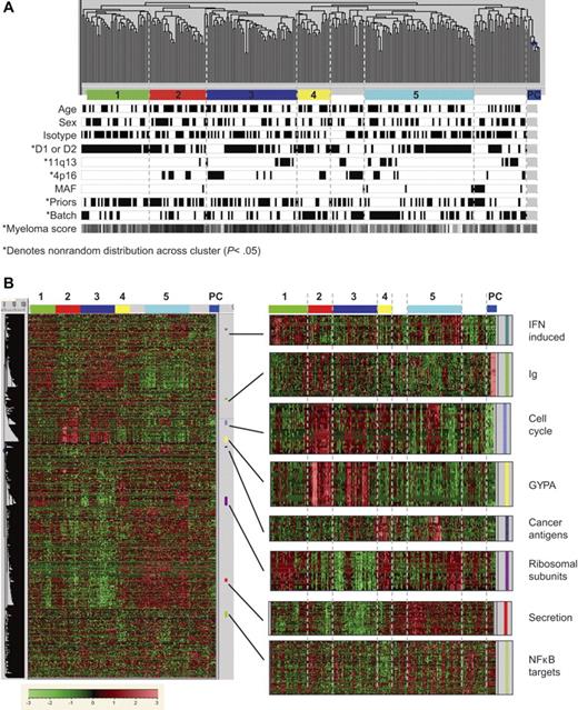 Figure 2. Sample relationships are influenced by clinical and gene-expression characteristics. Two hundred sixty-four myeloma patient samples and 6 normal plasma cell control samples were subject to unsupervised hierarchical clustering based on 9174 differentially expressed probe sets. Highly related branches (labeled groups 1-5) were identified by setting a fixed similarity metric (GeneMaths software; Applied Maths, Austin, TX) and requiring at least 12 samples for membership; unlabeled samples comprise various smaller groups. (A) Patient attributes are encoded below the sample dendrogram. Attributes with nonrandom distribution (P < .05) are indicated by asterisks. Black is associated with age older than 60 years, female sex, IgG isotype, 1 or 2 prior therapies, hybridization batch 1 (trials 024, 025, and 040), and low purity score. White is associated with age 60 years and younger, male sex, other isotypes, 3 or more prior therapies, hybridization batch 2 (trial 039), and high purity score. (B) An overview of the 9174 differentially expressed probe sets, with an expansion of specific functional groups.