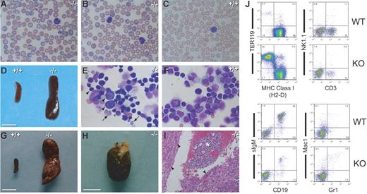 Figure 4. Basophilic macrocytes, splenomegaly, and extramedullary hematopoiesis in Pen KO mice. (A-B) Wright-Giemsa–stained blood smears of 2 representative Pen−/− mice. Note the basophilic macrocytes, target cells, overall larger RBCs, and the absence of microspherocytes. (C) A Wright-Giemsa–stained blood smear of a Pen WT mouse. Note the smaller RBC size, the absence of basophilic macrocytes, and a pale blue “shift cell” in the right lower corner. (D) The spleen of the Pen−/− mouse seen in panel A. A WT spleen is included for comparison. Bar = 1 cm. (E) A Wright-Giemsa–stained cytospin preparation of the spleen cells of the Pen−/− mouse seen in panel D. Most cells are intensely basophilic proerythroblasts or erythroblasts (arrowheads) or enucleated, basophilic RBCs (arrows). (F) A Wright-Giemsa–stained cytospin preparation of the spleen cells of a Pen WT mouse. Most cells are lymphocytes. Panels A, B, C, E, and F have the same magnification (300×). (G) The spleen of a Pen−/− mouse with multiple infarcts (pale scars). Bar = 1 cm. (H) The hepatic tumor of the same Pen−/− mouse seen in panel G. Bar = 1 cm. (I) A hematoxylin and eosin–stained thin section of panel H. The asterisk denotes extramedullary hematopoiesis; arrowheads, hepatocytes. (J) Flow cytometric analyses of the spleen cells seen in panels D-F. RBCs were removed by hypotonic lysis before staining with MAb. The percentage of cells in each quadrant/gate is shown. CD3 is a marker for T cells while CD19 is a marker for B cells. The frequency of TER119+ erythroblasts in Pen−/− spleen is increased by 150-fold.