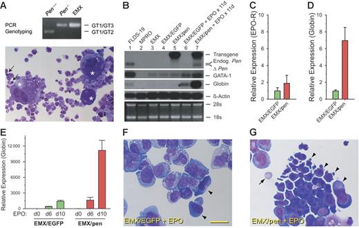 Figure 5. Pen enhances erythropoiesis in EMX C.1. (A) A Wright-Giemsa–stained cytospin preparation of EMX C.1. The asterisks denote megakaryocytes. Arrows point to 2 basophilic erythroblasts. Also visible are neutrophils with donut-shaped nuclei, monocytes, and mast cells. The genotyping result is at the top. (B) Northern analyses of the expression of Pen, GATA-1, βmajor-globin, and β-actin in EMX C.1, EMX/EGFP, and EMX/Pen without and with EPO stimulation. FLDS-19 serves as a positive control and MPRO as a negative control for GATA-1 and βmajor-globin. The same blot was sequentially hybridized to different probes. EMX C. 1 (lane 3) and EMX/EGFP (lane 4) did not express the 4.0 kb retroviral message harboring the mPen coding sequence (labeled “Transgene”) while EMX/pen did (lane 5, top panel). The 2.1 kb endogenous mPen message in FLDS-19 (lane 1) is indicated. ΔPen is a shortened Pen message transcribed from the KO allele. The level of βmajor-globin message roughly correlated with the numbers of erythroblasts. (C) Relative EPO-R expression in EMX/EGFP versus EMX/pen without exogenous EPO. Quantitative real-time RT-PCR was performed in triplicate as described in “Materials and methods,” and the data were normalized according to the levels of β-actin expression. The level of EPO-R expression in EMX/EGFP was taken as 1.0. Data represent means ± SD. (D) Relative βmajor-globin expression in EMX/EGFP versus EMX/pen without exogenous EPO. The data were normalized according to the levels of β-actin expression. The level of βmajor-globin expression in EMX/EGFP was taken as 1.0. The expression of βmajor-globin was likely stimulated by the small amount of EPO present in FBS. Means ± SD. (E) Relative βmajor-globin expression in EMX/EGFP versus EMX/pen stimulated with EPO (4 U/mL) for 0, 6, and 10 days. The data were normalized according to the levels of β-actin expression. The level of βmajor-globin expression in EMX/EGFP on day 0 was taken as 1.0. Data represent means ± SD. (F) A representative field of Wright-Giemsa–stained cytospin preparation of EMX/EGFP stimulated with EPO (4 U/mL) for 8 days. Arrowheads indicate 2 large erythroid progenitors. The rest are myeloid cells. Bar = 40 μM. (G) A representative field of Wright-Giemsa–stained cytospin preparation of EMX/pen stimulated with EPO (4 U/mL) for 8 days. Arrowheads indicate a large cluster of basophilic erythroblasts; arrow, an enucleated RBC.