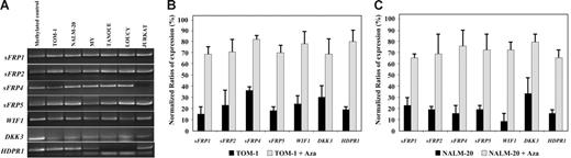 Figure 1. Methylation and expression analysis of Wnt-antagonist genes in ALL-derived cell lines. (A) MSP analysis of the methylated sequences in different ALL-cell lines. (B-C) Expression of Wnt inhibitors in TOM-1 (B) and NALM-20 (C) cell lines before and after treatment with the demethylating agent 5-aza-2′-deoxycytidine (Aza) demonstrating an up-regulation of gene expression after treatment. Gene expression was normalized with expression in normal lymphocytes (normalized ratio = 100%). The mean ± SD of 3 different experiments (B-C) is shown.