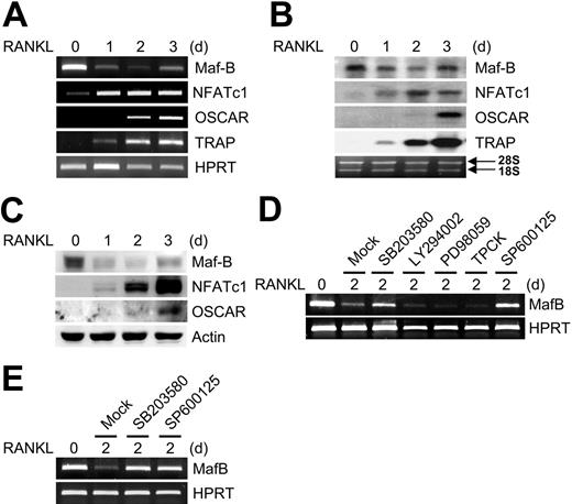 Figure 1. RANKL down-regulates the expression of MafB during osteoclastogenesis. (A) RAW264.7 cells were cultured for the indicated times in the presence of RANKL. RT-PCR was performed for the expression of MafB, NFATc1, OSCAR, TRAP, and HPRT. (B-C) BMMs were cultured for the indicated times in the presence of M-CSF and RANKL. Northern blot analysis (B) and Western blot analysis (C) were performed to assess the expression of the indicated genes. (D) RAW264.7 cells were cultured with RANKL for 2 days in the presence of various inhibitors: mock (DMSO), SB203580 (20 μM), LY294002 (10 μM), PD98059 (20 μM), TPCK (5 μM), or SP600125 (5 μM). RT-PCR was performed for the expression of MafB and HPRT. (E) BMMs were cultured with M-CSF and RANKL for 2 days in the presence of various inhibitors: mock (DMSO), SB203580 (20 μM), or SP600125 (5 μM). RT-PCR was performed for the expression of MafB and HPRT.