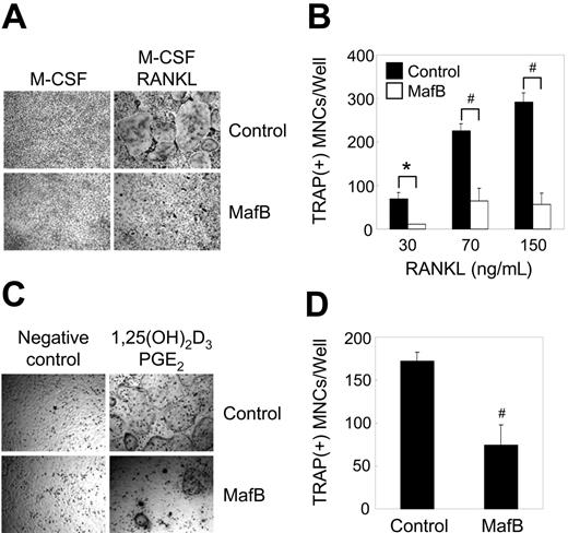 Figure 2. Overexpression of MafB in BMMs inhibits osteoclastogenesis. (A-B) BMMs were transduced with pMX-IRES-EGFP (control) or MafB retrovirus and cultured for 3 days with M-CSF alone or M-CSF and various concentrations of RANKL as indicated. (A) Cultured cells were fixed and stained for TRAP. (B) Numbers of TRAP+ multinucleated cells were counted (#P < .001 versus control vector; *P < .005 versus control vector). (C-D) BMMs were transduced with pMX-IRES-EGFP (control) or MafB retrovirus and cocultured for 6 days with osteoblasts in the presence of 1,25(OH)2D3 and PGE2. (C) Cultured cells were fixed and stained for TRAP. (D) Numbers of TRAP+ multinucleated cells were counted (#P < .001 versus control vector). Results are representative of at least 3 independent sets of similar experiments (A-D). (B,D) Data represent mean ± SD of triplicate experiments.