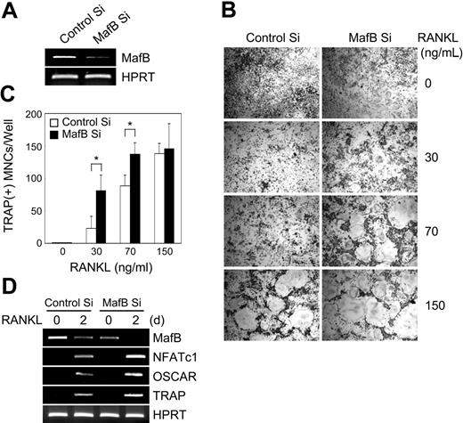 Figure 6. Enhancement of RANKL responses by MafB siRNA in BMMs. (A) Control or MafB siRNAs were transfected into BMMs. Total RNA was harvested from cultured cells 48 hours after transfection, and RT-PCR was performed with the primers specific for MafB and HPRT (control). (B) BMMs transfected with control or MafB siRNA were cultured for 3 days in the presence of M-CSF and various concentrations of RANKL. Cultured cells were fixed and stained for TRAP. (C) TRAP+ MNCs having more than 3 nuclei were counted as osteoclasts (*P < .01 versus control Si). Data represent mean ± SD of triplicate experiments. (D) BMMs transfected with control or MafB siRNA were cultured with M-CSF and RANKL (50 ng/mL) for the indicated times. Total RNA was harvested from cultured cells and RT-PCR was performed with primers specific for MafB, NFATc1, OSCAR, TRAP, and HPRT (control).