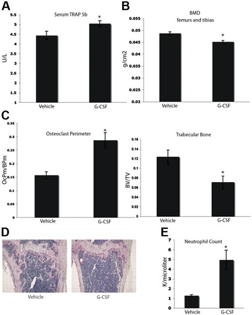 Figure 1. G-CSF enhances OC activity and increases bone resorption in vivo. (A) Serum was collected from mice 24 hours after completion of an 8-day course of 200 μg/kg G-CSF (n = 5) or vehicle (n = 5). Levels of TRAP 5b were measured by ELISA. G-CSF–administered mice have a 14% increase in levels of serum TRAP 5b (P = .03). (B) Mice were administered 200 μg/kg G-CSF (n = 19) or vehicle (n = 17) for 8 days. After the final dose (9 days), mice were killed and isolated femurs and tibias were fixed in formalin. BMD was measured on formalin-fixed bones by DEXA. Mice administered G-CSF demonstrated a 7% loss in BMD compared with vehicle-administered controls (P < .001). (C) Mice were administered 200 μg/kg G-CSF (n = 13) or vehicle (n = 17) for 8 days. After the final dose (9 days), mice were killed and tibial bones were isolated, decalcified and TRAP-stained to visualize OCs. G-CSF–administered mice had a statistically significant increase in OC perimeter and decrease in trabecular bone area compared with vehicle-administered mice (P = .02 and P < .005, respectively). (D) Representative histology of vehicle-administered versus G-CSF–administered mice. (E) G-CSF–administered animals (n = 3) demonstrated elevated neutrophil counts compared with vehicle-administered animals (n = 3; P = .01). All error bars represent standard error of the mean. Asterisks indicate statistical significance.