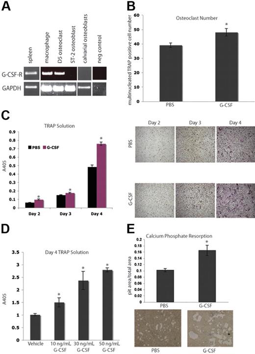 Figure 2. G-CSF enhances osteoclastogenesis in vitro. (A) RT-PCR was performed on mRNA from primary murine macrophages (Day 0), primary murine OCs (Day 5), a murine OB cell line, ST-2, and primary calvarial OBs. Macrophages and OCs express G-csf-r, while OBs do not. Spleen cDNA was a positive control. (B) Primary murine BMMs were grown in the presence of M-CSF and RANKL to promote differentiation of macrophages into OCs. Cultures were supplemented with 50 ng/mL G-CSF or PBS. Day-3 OCs were stained with TRAP; multinucleated TRAP-positive cells were counted. The addition of G-CSF led to a significant enhancement in osteoclastogenesis (P = .03). (C) A TRAP solution assay was performed to obtain relative levels of TRAP. The addition of G-CSF resulted in significant increases in TRAP activity at all days examined (P = .005, Day 2; P = .01, Day 3; and P < .005, Day 4). Representative images of the cells are shown. (D) To assess a dose response to G-CSF, a TRAP solution assay was performed to obtain relative levels of TRAP activity 4 days after plating BMMs in M-CSF and RANKL with 0, 10, 30, or 50 ng/mL G-CSF. Increasing doses of G-CSF resulted in increasing TRAP activity (P < .05 for each dose of G-CSF compared with vehicle). (E) Primary murine BMMs were grown in the presence of M-CSF and RANKL on osteologic calcium-phosphate–coated slides for 4 days. Cultures were supplemented with either 50 ng/mL G-CSF or PBS. Cultures supplemented with G-CSF demonstrated increased areas of calcium-phosphate resorption (P = .01). All error bars represent standard error of the mean. Asterisks indicate statistical significance.