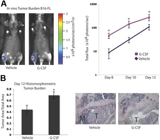 Figure 3. G-CSF administration increases tumor burden in bone in vivo. A. Mice were administered 200 μg/kg G-CSF (n = 13) or vehicle (n = 12) daily for 8 days. On the fifth day of treatment, 104 B16-FL tumor cells were injected into the right tibia. Tumor burden was assessed by bioluminescence imaging at days 8, 10, and 12 after tumor cell injection. A representative image from day 12 is shown here. G-CSF–administered mice demonstrated an increased tumor burden compared with vehicle-administered animals (P < .006, G-CSF vs vehicle; pooled data from 2 independent experiments; y-axis is log scale). (B) After tumor cells were injected (12 days), mice were killed and bones were isolated. Histomorphometric analysis confirmed the increased tumor burden seen by imaging in the G-CSF–administered animals (P = .01). Representative histology depicted here; M indicates marrow; T, tumor. All error bars represent standard error of the mean. Asterisks indicate statistical significance.