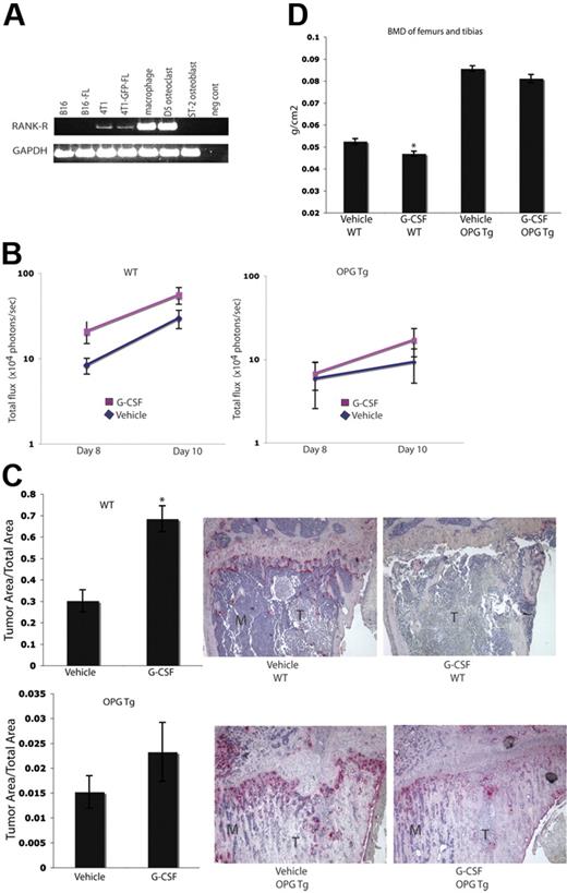 Figure 4. Enhanced tumor growth in bone following G-CSF administration is not seen in OC-defective mice. (A) RT-PCR was performed on mRNA harvested from murine tumor cell lines. Parental 4T1 and 4T1-GFP-FL cells express Rank-r, while B16 and B16-FL cells do not. (B) OPGTg or wild-type mice were administered 200 μg/kg G-CSF or drug vehicle daily for 8 days. On the fifth day of treatment, 104 B16-FL tumor cells were injected into the right tibia. Tumor burden was assessed by bioluminescence imaging on days 8 and 10 after tumor cell injection. G-CSF–administered wild-type mice (n = 12) demonstrated an increased tumor burden compared with vehicle-administered animals (n = 17; P = .057), while OPGTg mice demonstrated equivalent tumor growth (n = 16 vehicle-administered OPGTg mice, n = 20 G-CSF–administered OPGTg mice; P = .64; results were pooled from 5 independent experiments; y-axis is log scale). (C) Histomorphometric analysis confirmed the increased tumor burden seen by imaging in the G-CSF–administered wild-type mice (P < .001 wild-type, P = 0.24 OPGTg). Representative histology depicted here. M indicates marrow; T, tumor. (D) DEXA was used to measure BMD on formalin-fixed bones. G-CSF–administered wild-type mice (n = 10) showed an 8% decrease in BMD compared with vehicle-administered controls (n = 13; P = .004), while G-CSF–administered OPGTg mice (n = 11) demonstrated equivalent BMD compared with vehicle-administered controls (n = 9; P = .06). All error bars represent standard error of the mean. Asterisks indicate statistical significance.