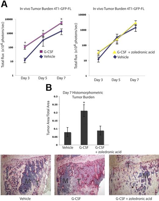 Figure 5. Tumor growth in bone is increased following G-CSF administration and is decreased by OC blockade in a second osteolytic model. (A) Mice were administered 200 μg/kg G-CSF (n = 18) or vehicle (n = 17) daily for 8 days or 200 μg/kg G-CSF daily for 8 days and 1 dose (0.75 μg) of zoledronic acid 1 day prior to tumor cell injection (n = 9). On the fifth day of G-CSF or vehicle administration, 104 4T1-GFP-FL tumor cells were injected into the right tibia. Tumor burden was assessed by bioluminescence imaging at days 3, 5, and 7 after tumor cell injection. G-CSF–administered mice demonstrated increased tumor burden compared with vehicle-administered mice, while G-CSF–administered mice given zoledronic acid showed equivalent tumor burden to vehicle mice (P < .001 G-CSF vs vehicle; P = .48 G-CSF plus zoledronic acid vs vehicle; pooled data from 3 independent experiments; y-axis is log scale). (B) After tumor cells were injected (7 days), mice were killed and bones were isolated. Histomorphometric analysis confirmed the increased tumor burden seen by imaging in the G-CSF–administered animals (P = .046). Representative histology depicted here; M indicates marrow; T, tumor. All error bars represent standard error of the mean. Asterisks denote statistical significance.