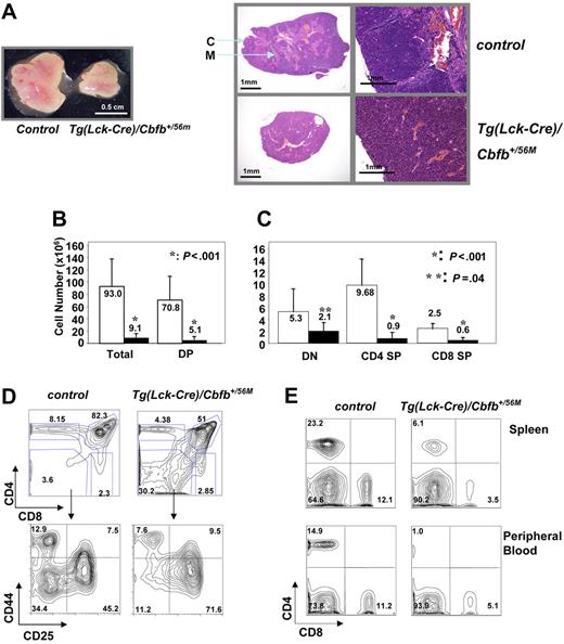 Figure 2. T-cell developmental defects in the adult Tg(Lck-Cre)/Cbfb+/56M mice. (A) Tg(Lck-Cre)/Cbfb+/56M mice had smaller thymi (right) and their thymic architecture appeared to be homogeneous, as compared to the control mice (left). C indicates cortex; M: medulla. Left panel (gross view): pictures were taken with an Olympus SZ-40 (Tokyo, Japan) dissecting microscope camera with zoom setting at 2.5×. For the panel on the right, the 2 pictures on the left were taken with an Olympus SZ-40 dissecting microscope camera with zoom setting at 4×; the 2 pictures on the right were taken with a Nikon ECLIPSE E800 (Tokyo, Japan) microscope at 100× (10×/0.45 NA objective and 10× eyepiece). (B) Total and DP thymocyte numbers from adult thymi are graphed. (C) Numbers of DN, CD4+ SP, and CD8+ SP thymocytes are graphed. For panels B and C: □, littermate controls (n = 9); ▪, Tg(Lck-Cre)/Cbfb+/56M mice (n = 10). Statistically significant P values (Student t test) are indicated. (D) Representative contour plots of cell surface marker expression of thymocytes from Tg(Lck-Cre)/Cbfb+/56M and littermate control mice. The cells were stained with CD4, CD8, CD44, and CD25. The top panels show CD4 and CD8 distribution, and the bottom panels show CD44 and CD25 staining of DN cells. (E) Representative contour plots of CD4 and CD8 expression of spleen and peripheral blood cells from Tg(Lck-Cre)/Cbfb+/56M and littermate control mice.