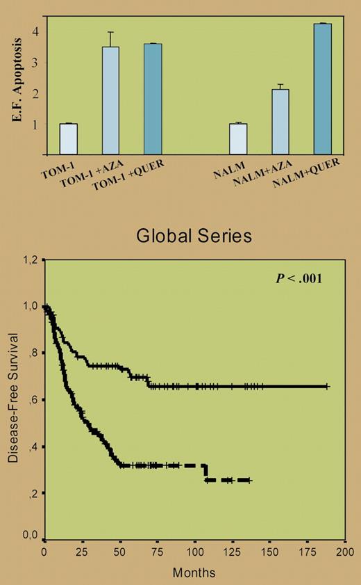 (Top) Inhibition of the Wnt signaling by 5-aza-2′deoxycytidine and quercetin induces apoptosis of ALL cells. Apoptosis of ALL cells was significantly higher after treatment with quercetin (P < .05). (Bottom) Kaplan-Meier survivor function for patients with ALL. DFS curves for all the patients enrolled in this study, with an adverse impact of hypermethylated WNT inhibitors. See the complete figures in the article beginning on page 3462.