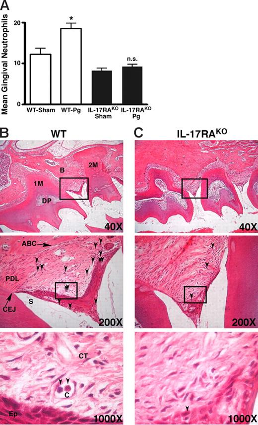 Figure 4. Defective neutrophil migration to the gingiva in IL-17RAKO mice. IL-17RAKO or WT mice were infected with Pg 3 times over 5 days and killed 24 hours after the final inoculation. Sections were stained with H&E. Images were acquired with a Zeiss Axioimager 2I microscope system. (A) At least 80 slides per condition were examined for neutrophils by oil immersion microscopy at ×1000 magnification, and the number of neutrophils normalized to number of teeth present per slide was determined. Standard deviations are shown. Statistical significance of differences between Pg-infected and sham-infected was assessed by unpaired t test (P < .05). (B-C) Sample slides showing neutrophils in representative Pg-infected WT (panel B) or IL-17RAKO (panel C) gingival slices imaged with 40×/0.10, 200×/0.45, and 1000×/1.30 oil-immersion objective lenses. Arrows indicate polymorphonuclear neutrophils. 1M indicates first molar; 2M, second molar; PDL, periodontal ligament; B, bone; ABC, alveolar bone crest; CEJ, cementoenamel junction; DP, dental pulp; CT, connective tissue; Ep, epithelium; C, capillary; and S, sulcus.