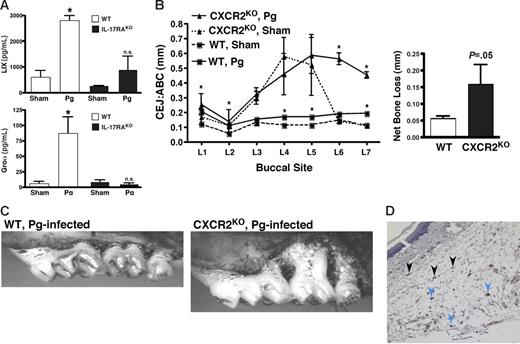 Figure 5. CXC chemokine expression in situ. (A) IL-17RAKO mice fail to up-regulate CXC chemokines in response to Pg infection. Serum samples from WT and IL-17RAKO mice in Figure 1 were analyzed for Groα and LIX by ELISA. Standard deviations are shown. *Statistically significant differences between Pg-infected compared with Sham-infected mouse strains as assessed by unpaired t test (LIX, P < .001; Groα, P < .05). n.s. indicate not significant. (B) CXCR2KO mice are susceptible to Pg-induced bone loss. CXCR2KO or WT mice (BALB/c background) were infected with Pg or sham (n = 4-6), and ABC/CEJ distances on the left maxillary jaw were evaluated as in Figure 1. Net bone loss with standard deviations is shown. (C) Representative images of maxillary jaws in Pg-infected WT or CXCR2KO mice, taken as in Figure 1D. (D) Source of CXC chemokines in Pg infection. Sections from Pg-infected WT mice (adjacent sections as in Figure 4B) were stained with antisera that recognizes Groα, LIX, and MIP2. Blue arrows indicate representative monocyte/macrophages; black arrows indicate representative fibroblasts. Image obtained with a 200×/0.45 objective lens. n.s. indicates not significant.