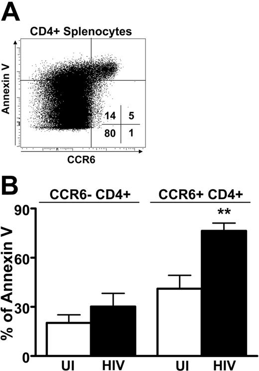 Figure 7. Apoptosis of CCR6+ CD4 T cells: comparison of uninfected and HIV-infected individuals. (A) Sensitivity to apoptosis of CCR6-expressing splenocytes. Representative staining of splenocytes for expression of CCR6 and annexin V within CD8+ splenocytes. Percentages of cells in each quadrant are indicated. (B) The percentage of annexin V+ splenocytes was studied according to the expression of CCR6 within CD4+ splenocytes for 5 UI (□) and 5 HIV-infected (▪) individuals. **P < .01. Error bars represent SEM.