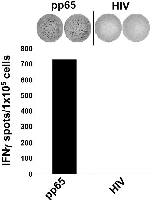 Figure 3. Antigen specificity of the generated CMV-CTL line. A CTL line specific for the HLA-A2 binding pp65-CMV antigen–derived peptide was generated from a CMV-positive healthy donor (HLA-A2+). The specificity of the CTLs was analyzed in IFN-γ ELIspot assays. The CTL line raised against an HLA-A2–binding pp65-derived peptide, specifically recognized autologous DCs loaded with the corresponding peptide but not an irrelevant HIV-derived peptide. The data shown are representative of 5 independent experiments.