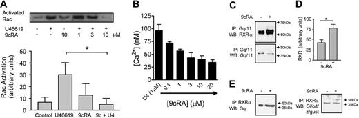 Figure 2. RXR binds and inhibits Gq signaling in human platelets. (A) Top panel shows a typical Rac activation assay blot; lower panel shows densitometry measurements (arbitrary units) from 3 blots. Rac activation was measured at 30 seconds after U46619 stimulation. 9cRA was given as standard as a 3-minute pretreatment. For densitometry measurements vehicle pretreatment (control), U46619 (1 \#956;M), 9cRA (10 \#956;M), and 9cRA followed by U46619 (9c+U4; 9cRA 10 \#956;M; U46619 1\#956;M) are shown. *P < .05 by repeated measures 1-way ANOVA, followed by Bonferroni post test. (B) 9cRA (0.1-20 \#956;M) inhibits U46619-induced (U4; 1 \#956;M intracellular Ca2+ release in washed platelets. Figure represents the mean ± SEM changes in Ca2+ release (nM) in 4 × 108 platelets. (C) RXR binds Gq/11 in a ligand-dependent fashion. Human PRP was treated with 9cRA (10 \#956;M) for 3 minutes. Platelet lysates were immunoprecipitated (IP) with anti-Gq/11 and Western blotted (WB) for RXR\#945; (top panel) or Gq/11 (lower panel). (D) Densitometry measurements (arbitrary units) from 3 blots for RXR\#945; expression detected after 9cRA (10 \#956;M; 3 minutes) treatment and Gq/11 IP. *P < .05 by unpaired t test. (E) RXR binds Gq/11 but not Gi/o/t/z/gust in a ligand-dependent fashion. Human PRP was treated with 9cRA (10 \#956;M) for 3 minutes. Platelet lysates were immunoprecipitated (IP) with anti-RXR\#945; and Western blotted (WB) for Gq/11 (top panel) or Gi/o/t/z/gust (lower panel); arrow indicates 40-kDa band.