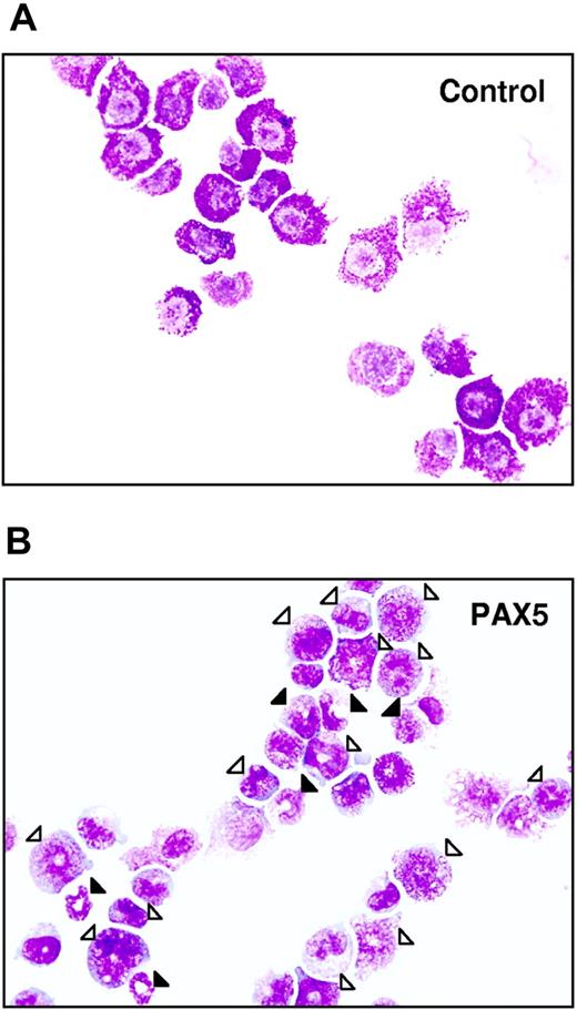 Figure 3. Biphenotypic B220+GR-1/MAC-1+ cells generated from PAX5-transduced LSK cells have an immature myeloid morphology. Typical morphology of May-Grünwald– and Giemsa-stained FACS-purified GFP+ control (A) and PAX5-transduced (B) biphenotypic GFP(PAX5)+B220+GR-1/MAC-1+ cells from liquid culture at 24 days after transduction. Open triangles indicate immature granulocytes (promyelocytes, myelocytes), whereas filled triangles point at more mature forms of granulocytes (metamyelocytes, band and segmented forms). Original magnification × 500.