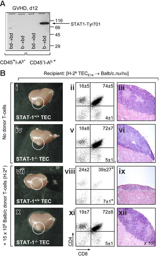 Figure 3. Abrogation of STAT-1 signaling in TECs prevents injury in vivo. (A) Phosphorylation of STAT-1 at residue 701 was detected by Western blot in purified primary adult CD45−I-Ab+ TECs and CD45+I-Ab− thymocytes from mice with aGVHD (b→bd, day 12). (B) Analysis of T cell-deficient Balb/c.nu/nu mice (H-2d) carrying a heterotopic thymus derived from E14 fetal STAT1+/+ and STAT-1−/− TECs (strain 129; H-2b), respectively (Figure S1). Panels i-vi depict gross anatomy (left), flow cytometric analysis (middle), and histology (right) of ectopic thymi located under the kidney capsule (circles) of recipients not further treated with allogeneic donor T cells. One representative mouse per group is shown. Images in panels iii, vi, ix, and xii were visualized using a Nikon E600 microscope (Nikon, Zurich, Switzerland) equipped with a 10×/0.30 NA objective. Images were acquired using a Nikon DXM 1200F camera and Nikon ACT-1 software version 2.62. Panels vii-xii depict the analyses of ectopic thymi from mice that have received 15 × 106 Balb/c T cells 3 weeks earlier. For analysis of ectopic T-cell development, relative numbers (in percent) of immature CD4+CD8+ and SP mature thymocytes, respectively, are shown. A total of 3 mice were analyzed for each transplantation group. The experiment was performed twice, with identical results; *P < .05 versus mice receiving no T cells.